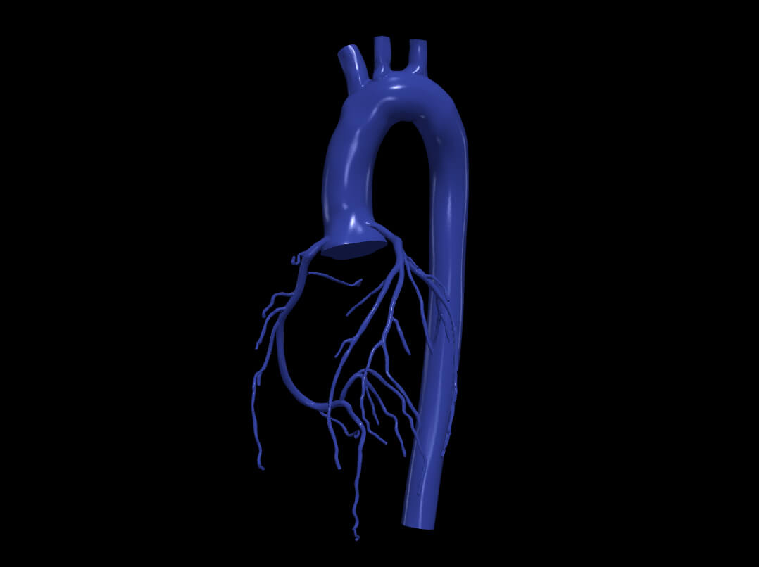3D Model of Aorta and Coronary Arteries - 6Pack by azekapeka