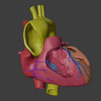 3D Model of Heart With Bicuspid Aortic Valve - Bav by azekapeka
