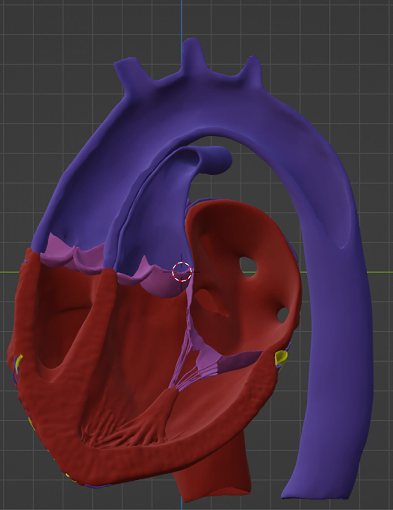 Transposition Model 3D Model of Heart With Transposition of The Great Arteries by azekapeka