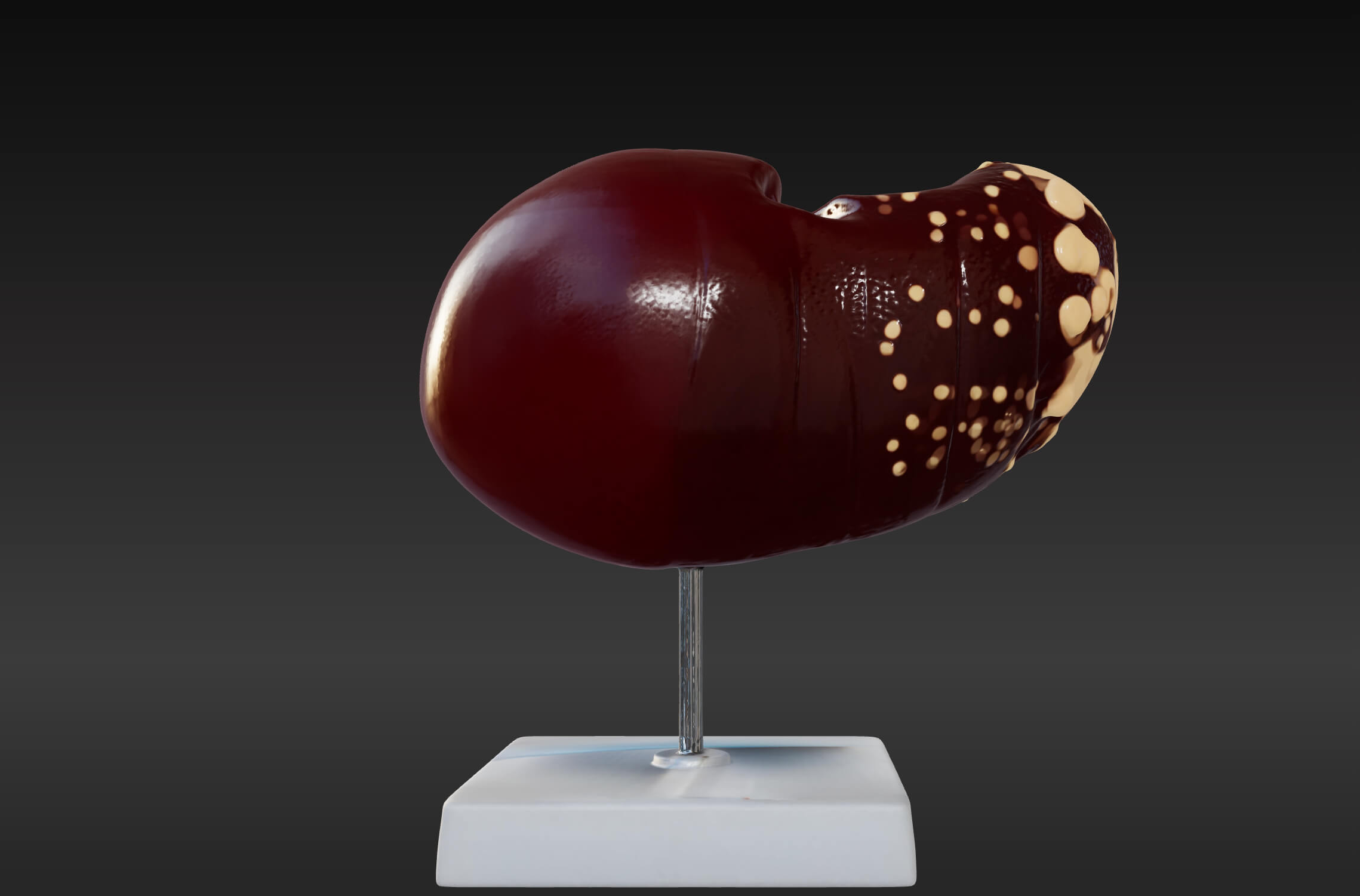 3D Model of Human Liver With The Progression of Liver Diseas by azekapeka