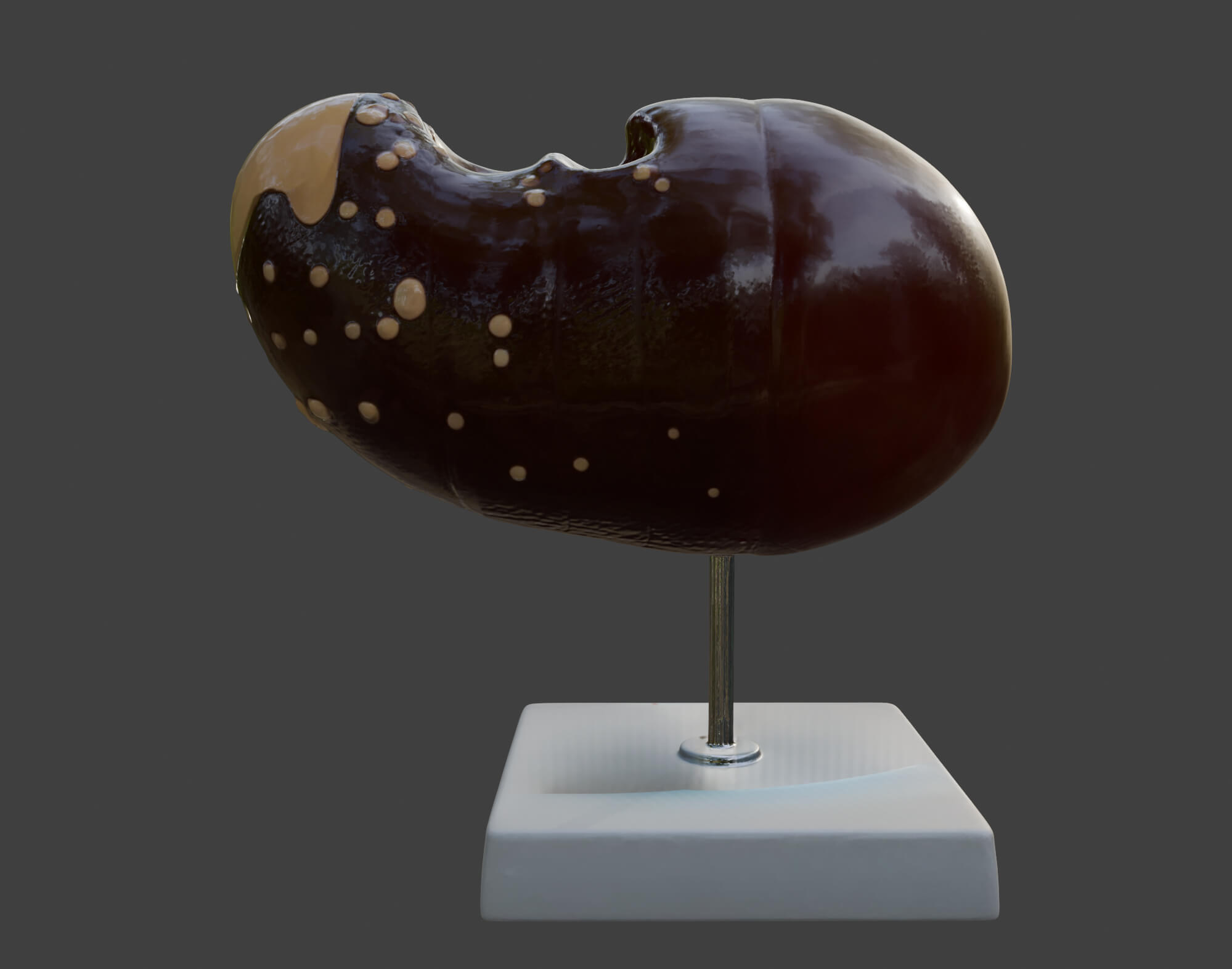 3D Model of Human Liver With The Progression of Liver Diseas by azekapeka