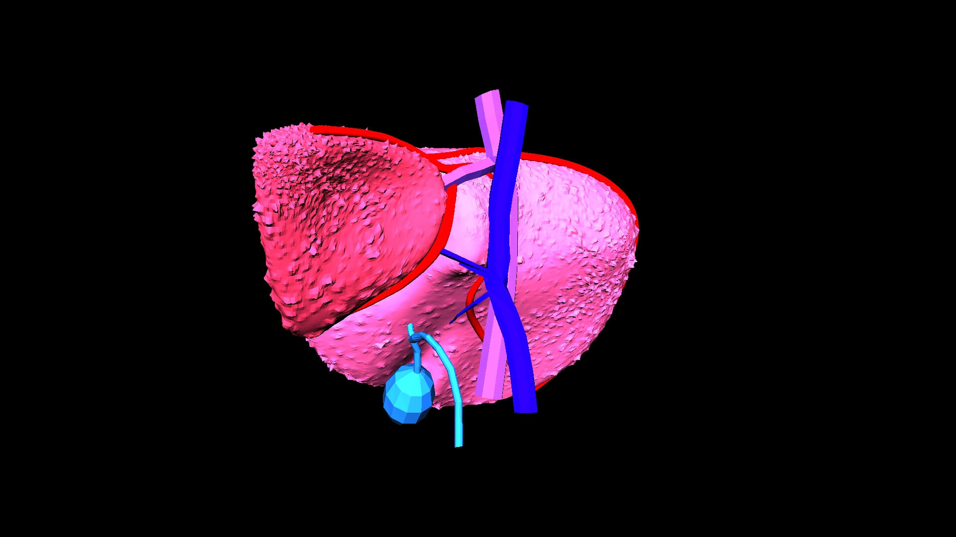 3D Model of Liver With Cirrhosis by azekapeka