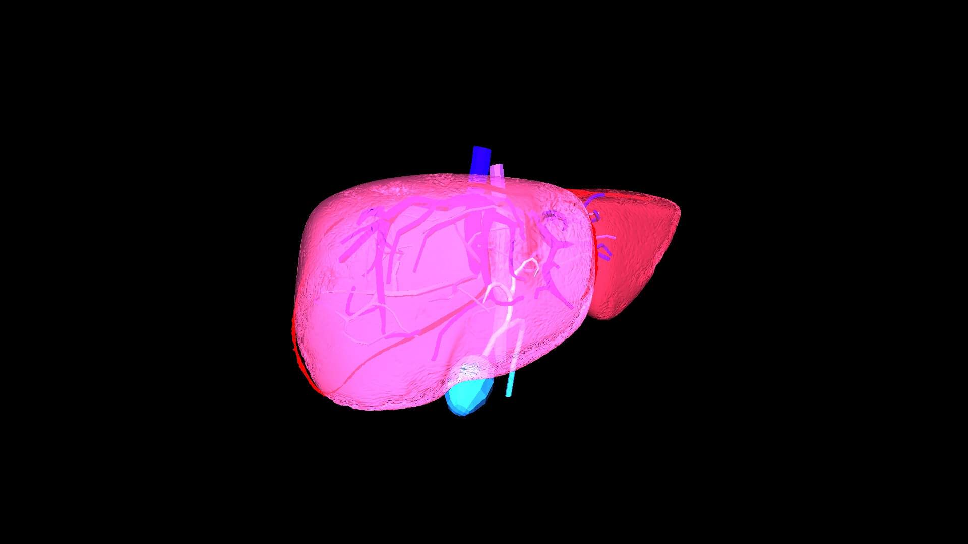 3D Model of Liver With Cirrhosis by azekapeka
