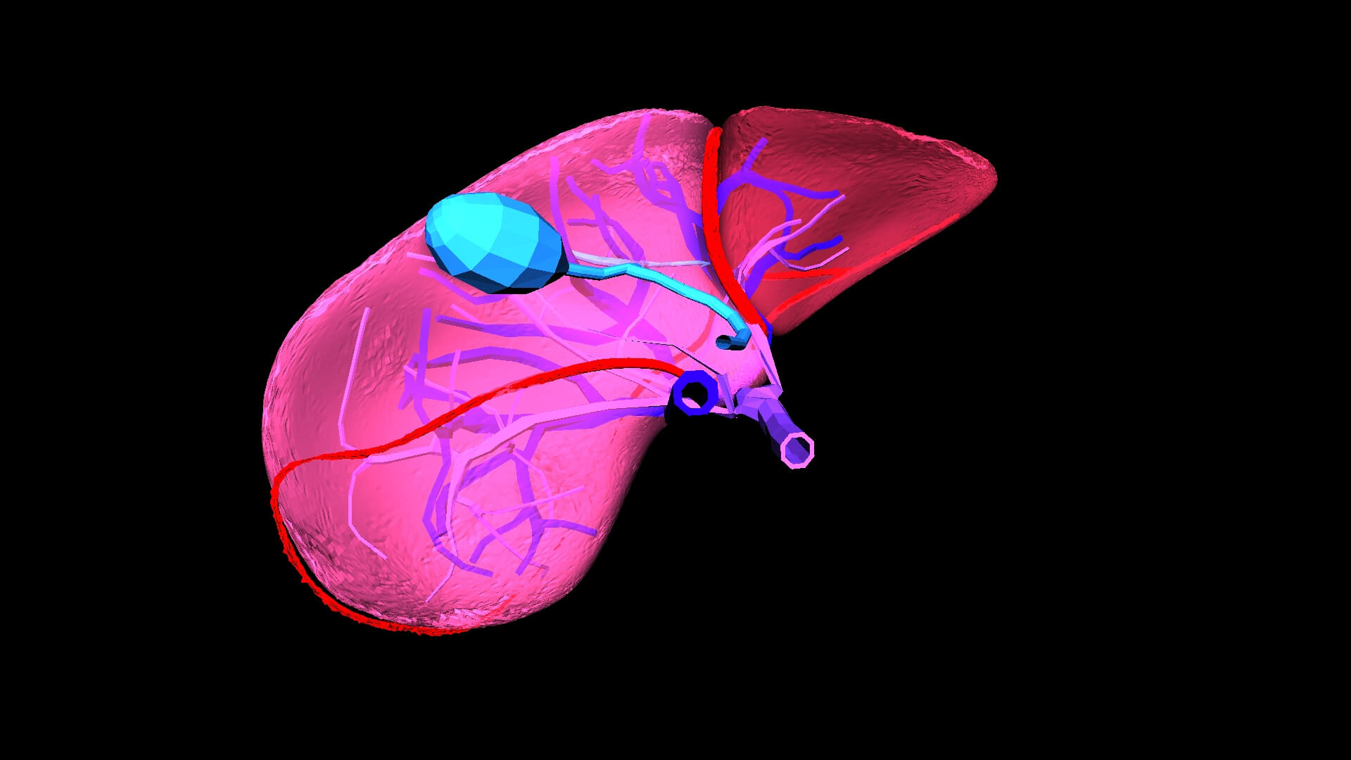 3D Model of Liver With Cirrhosis by azekapeka