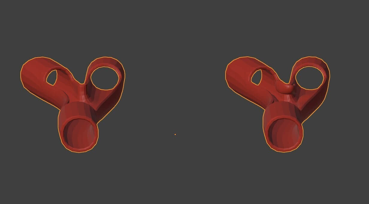 3D Model of Peripheral Artery Disease by azekapeka