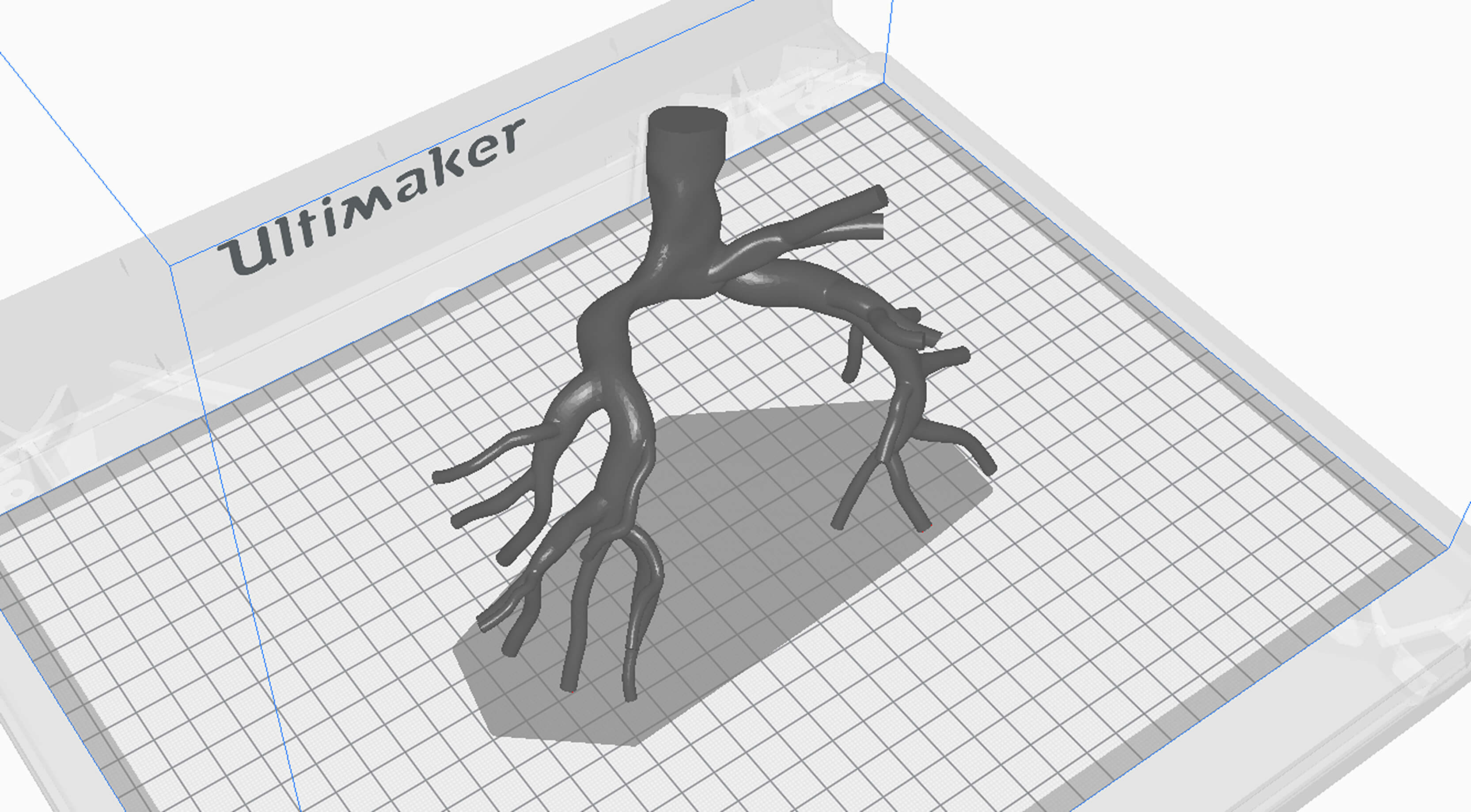 3D Model of Pulmonary Arteries (Fontan Procedure) by azekapeka