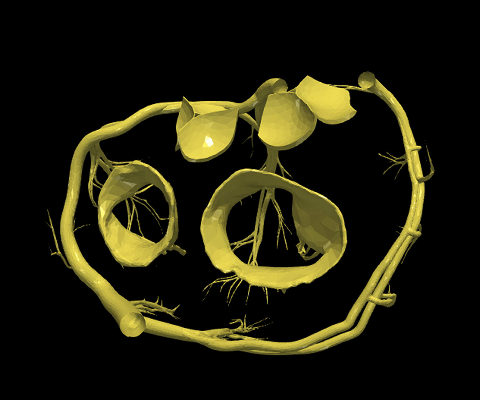 Transposition Model 3D Model of Transposition of The Great Arteries Open Duct by azekapeka