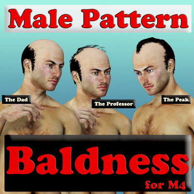 Male Pattern Baldness for M4