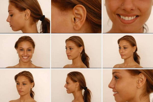 Skin Textures for 3D Characters