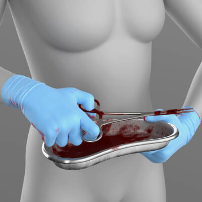 Surgical Gloves and Surgical Instruments Set G9