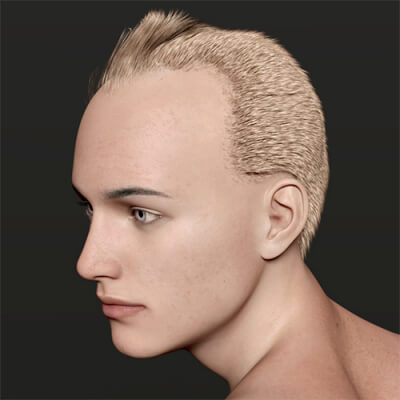 Receding Hair for G8 8.1 and G9 Males