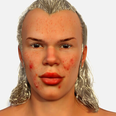 Erling for G8M and G8.1M
