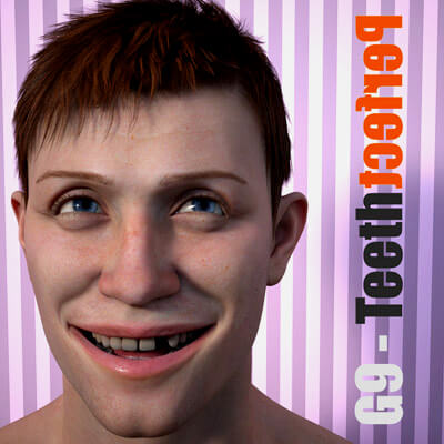 Teeth Perfect for Genesis 9