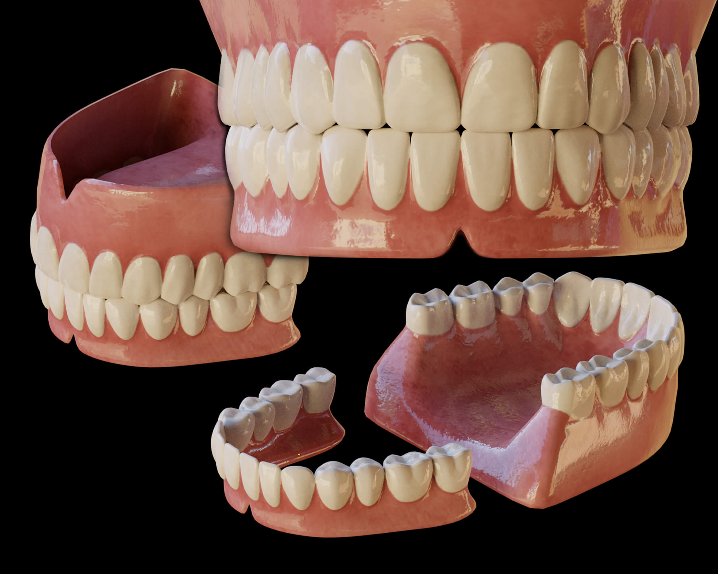 Human Teeth Modifications Human Teeth Prosthesis - 3D Model by rossty3d