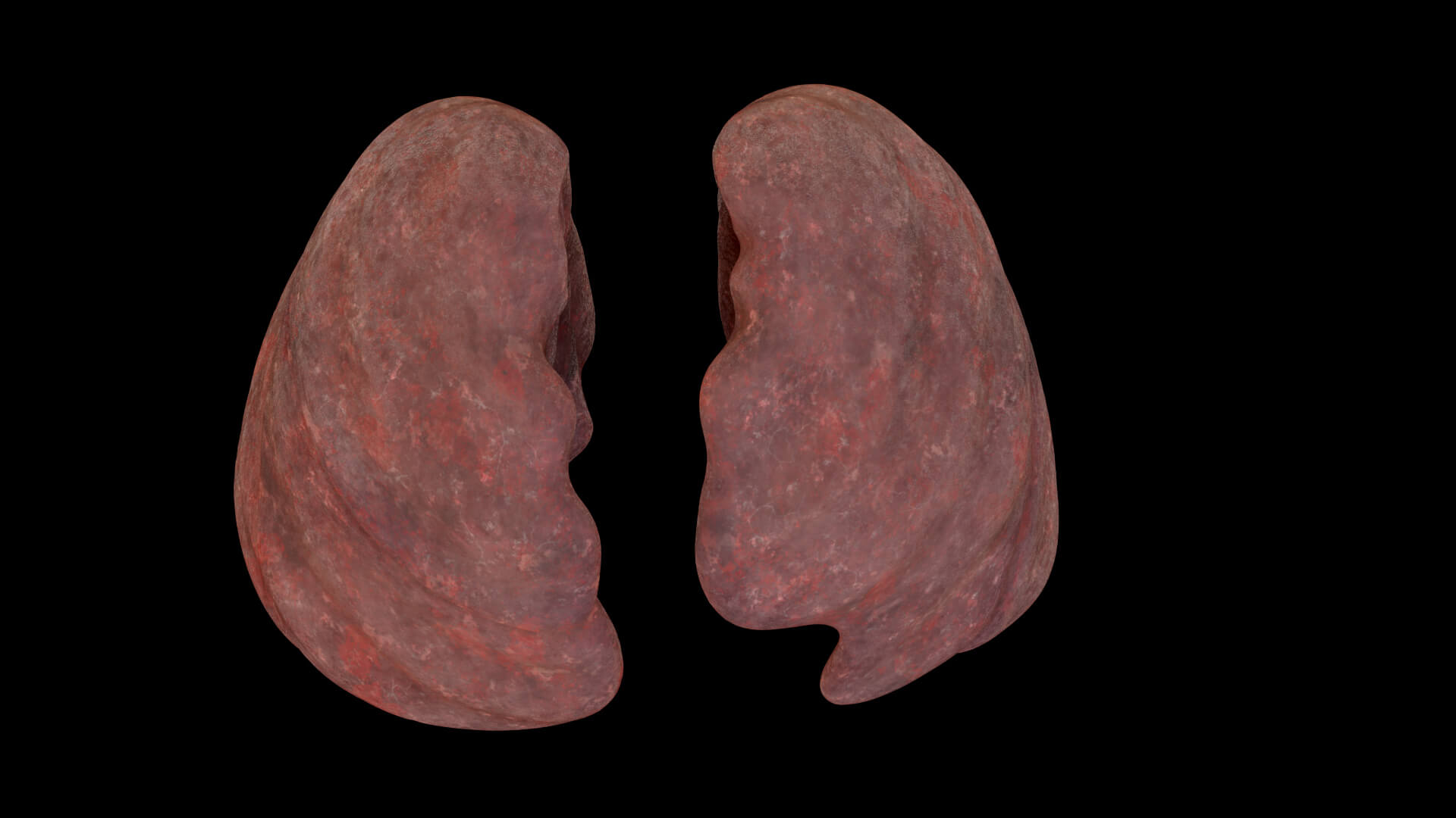 Smoker Human Lungs - 3D Model by ryro_animation