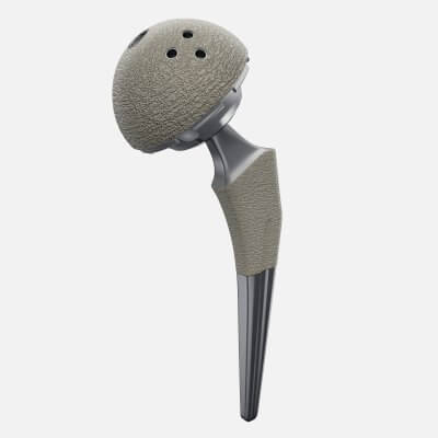 Femoral Prosthesis