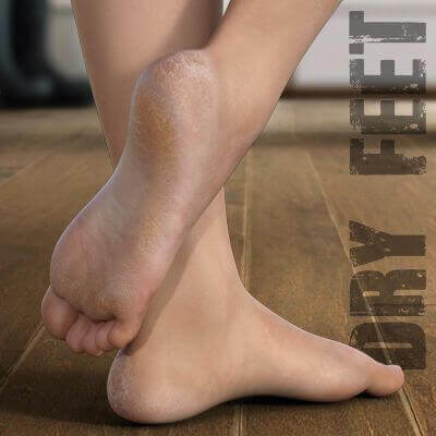 Dry Feet For Genesis 3 and 8
