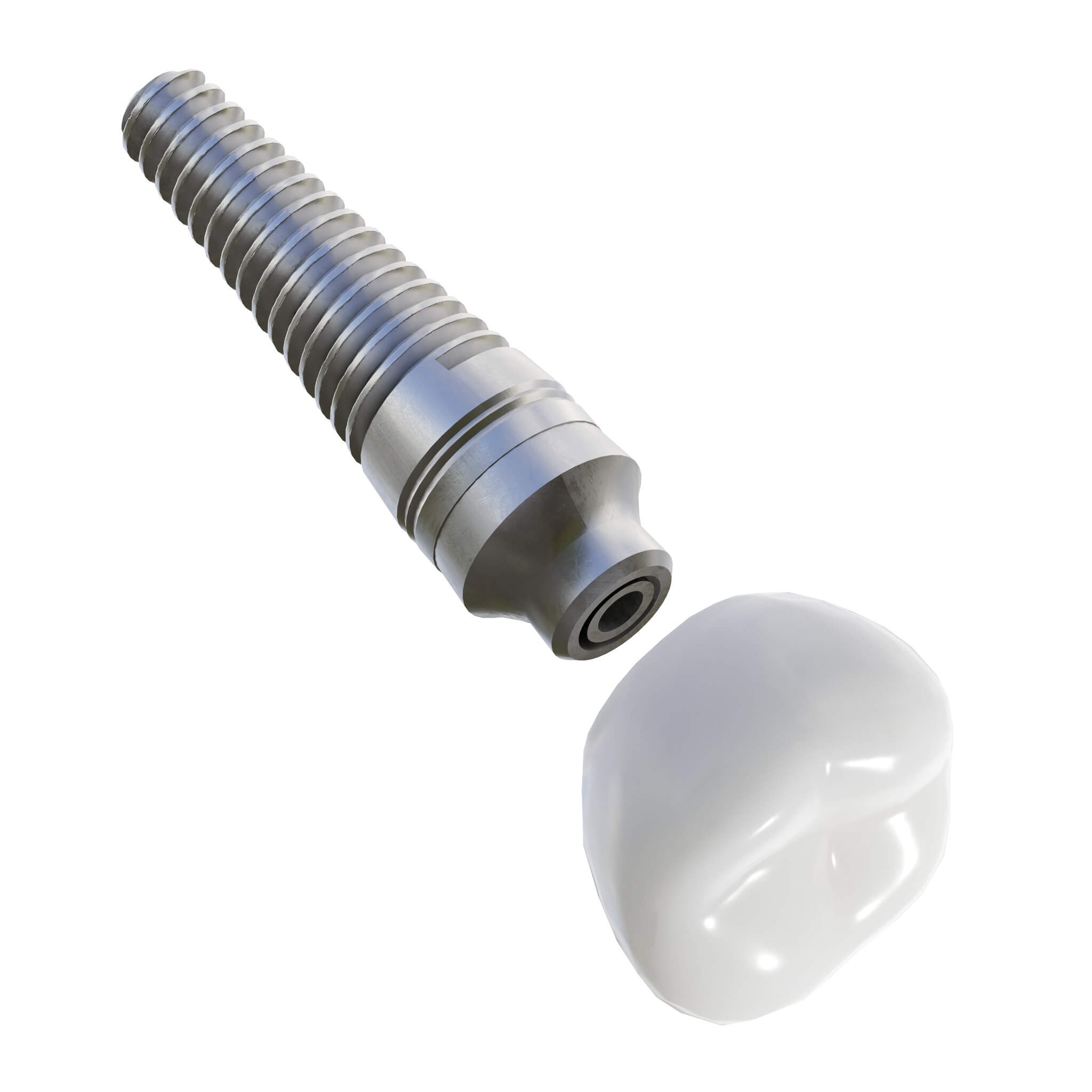 Dental Implant Animation 3D Model by zames1992d
