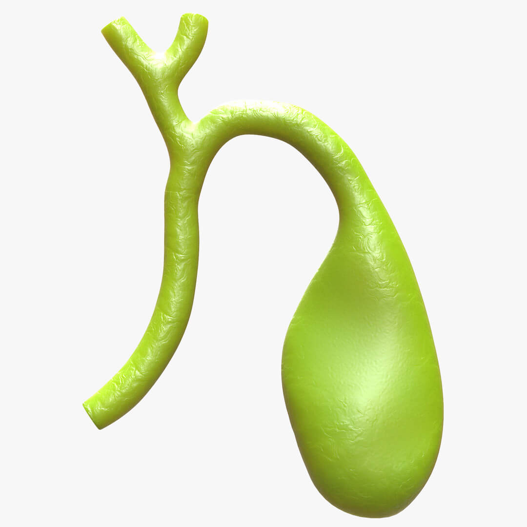 Gallbladder With Gallstones 3D Model by zames1992d